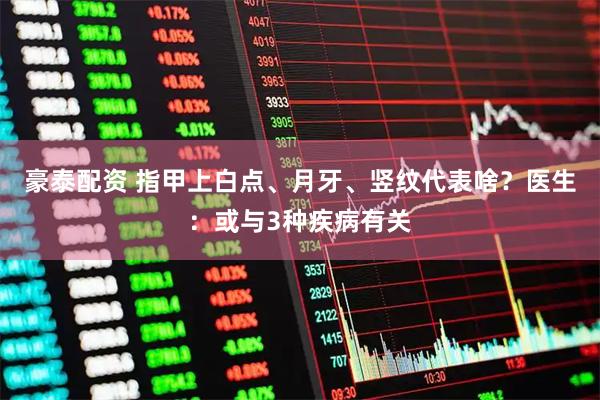 豪泰配资 指甲上白点、月牙、竖纹代表啥?医生:或与3种疾病有关